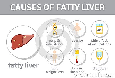 Causes of fatty liver Stock Photo