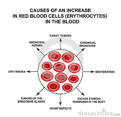 Causes of increased red blood cells. Cells erythrocytes. Hemoglobin. The structure of red blood cells. Infographics Vector Illustration