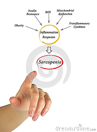 Causes of Sarcopenia Stock Photo