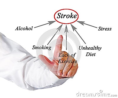 Causes of Stroke Stock Photo