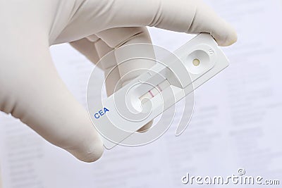 CEA positive Stock Photo