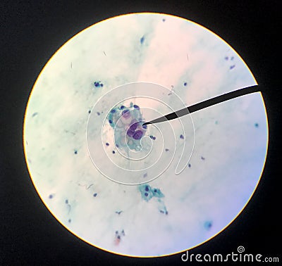 Cells in reproductive female cytology and histology concept Stock Photo