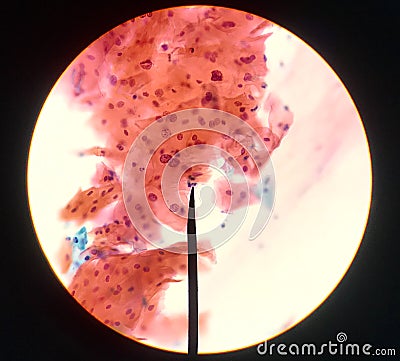 Cells in reproductive female cytology and histology concept Stock Photo