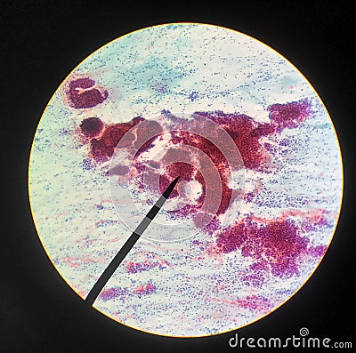 Cells in reproductive female cytology and histology concept Stock Photo