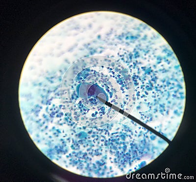 Cells in reproductive female cytology and histology concept Stock Photo