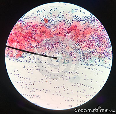 Cells in reproductive female cytology and histology concept Stock Photo