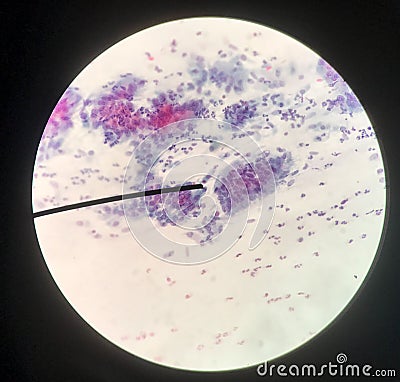 Cells in reproductive female cytology and histology concept Stock Photo