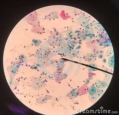 Cells in reproductive female cytology and histology concept Stock Photo