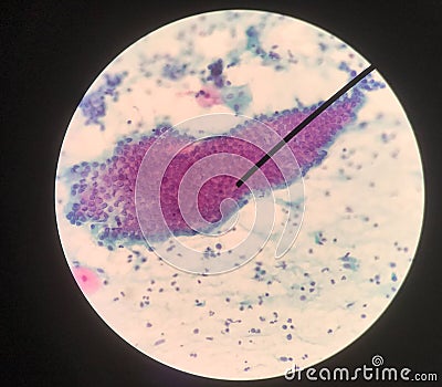 Cells in reproductive female cytology and histology concept Stock Photo