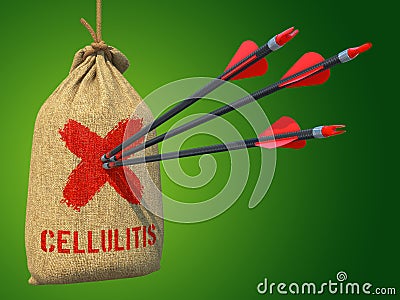 Cellulitis - Arrows Hit in Red Target. Stock Photo