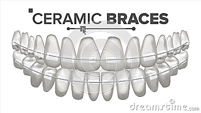 Ceramic Braces Vector. Human Jaw. Dentist, Orthodontist Poster Element. 3D Realistic Isolated Illustration Vector Illustration