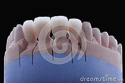 Ceramic teeth Stock Photo