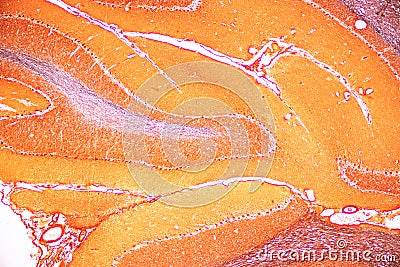 Cerebellum, Thalamus, Medulla oblongata, Spinal cord and Motor Neuron human under the microscope. Stock Photo