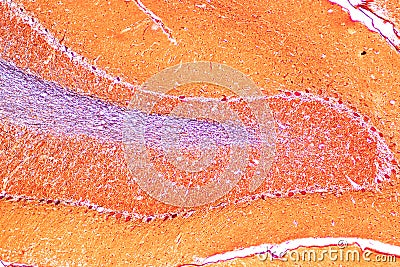 Cerebellum, Thalamus, Medulla oblongata, Spinal cord and Motor Neuron human under the microscope. Stock Photo