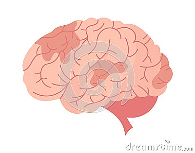 Cerebrovascular Brain Disease Vector Illustration