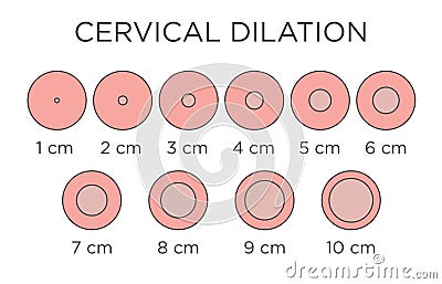 Cervial Dilation Medical Illustration - chart in centimeters Vector Illustration