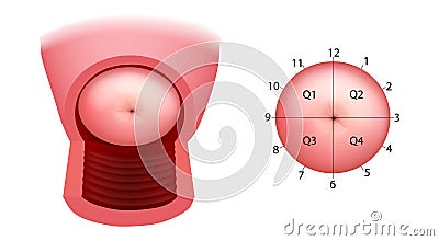 Cervix quadrants and directions. The anatomical position of the cervix. Cervix uteri anatomy. Colposcopy. Vector Illustration