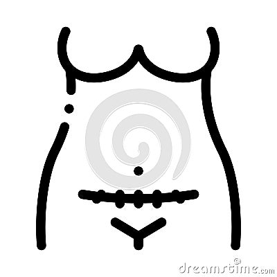 cesarean section black icon vector illustration Cartoon Illustration