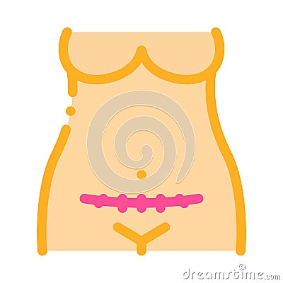 cesarean section color icon vector illustration Cartoon Illustration
