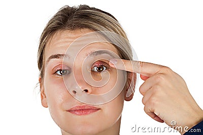 Chalazion - Eyelid infection Stock Photo