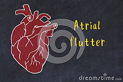 Learning cardio system concept. Chalk drawing of human heart and inscription Atrial flutter Stock Photo