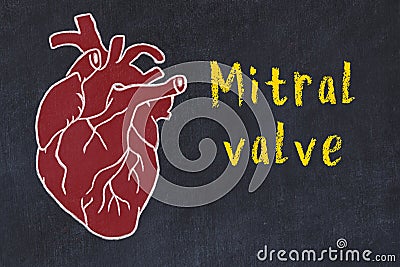 Chalk sketch of human heart on black desc and inscription Mitral valve Stock Photo