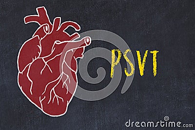 Chalk sketch of human heart on black desc and inscription PSVT Stock Photo