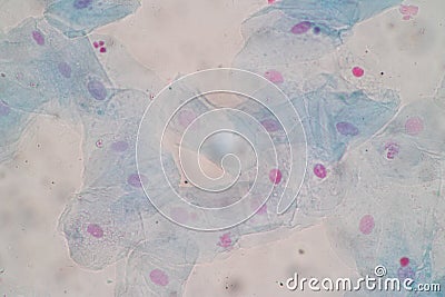 Histological sample Squamous epithelial cells under microscope. Stock Photo