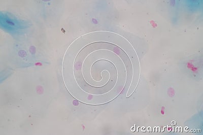 Histological sample Squamous epithelial cells under microscope. Stock Photo