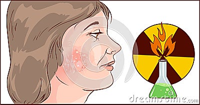 Chemical burns to face Vector Illustration