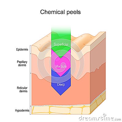 Chemical peel. Skin layers Vector Illustration