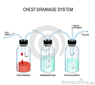 Chest drainage system Vector Illustration
