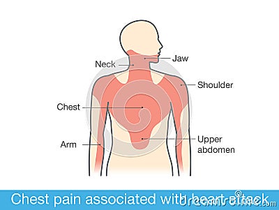 Chest pain associated with heart attack Vector Illustration