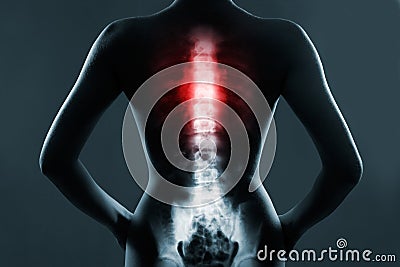 The chest spine is highlighted by red colour Stock Photo