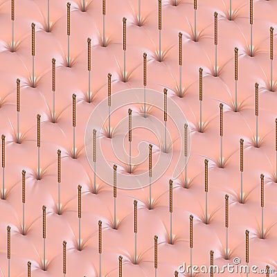 Chesterfield acupuncture needles Stock Photo