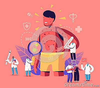 Chicken Pox Varicella Symptoms Concept. Tiny Doctors Characters with Stuff near Huge Boy with Red Pimples on Body Vector Illustration