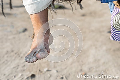 A child boy dirty feet in refugee camp Stock Photo