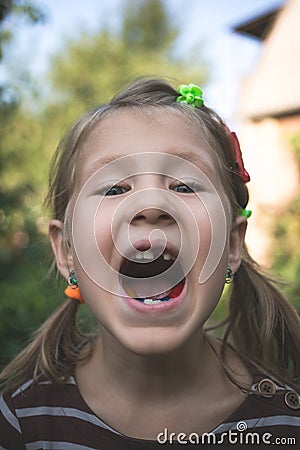 Child with a dental orthodontic device and without one tooth Stock Photo