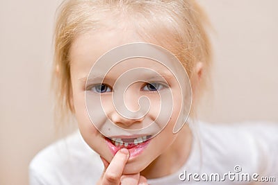 Child girl shows changing milk tooth Stock Photo