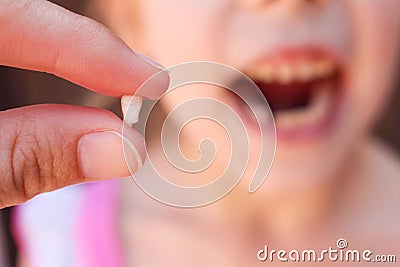 child has lost baby tooth. Stock Photo