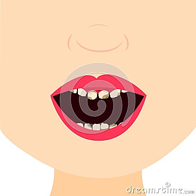 Child with milk tooth decayed Vector Illustration