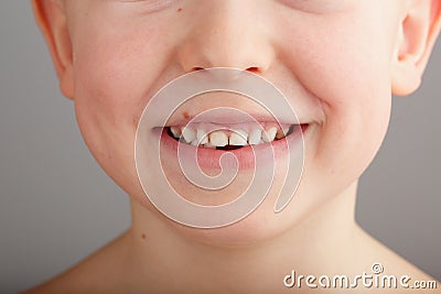 A child`s smile without lower baby teeth. A hole in a child`s smile. Fun concept Stock Photo