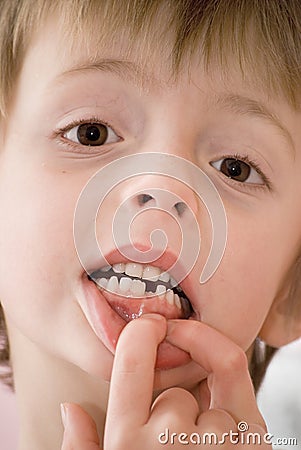 Child showing new tooth Stock Photo