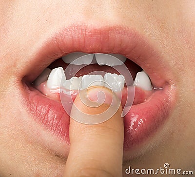Child shows tooth Stock Photo