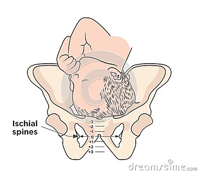 Child in womb - pelvis ischial spines - medical illustration Vector Illustration