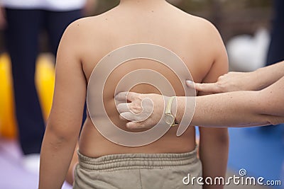 Childhood obesity Stock Photo