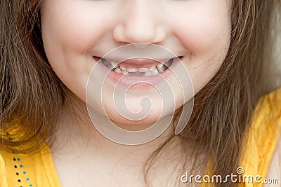 Childish face lower part with missing front lower milk teeth in a smiling mouth Stock Photo