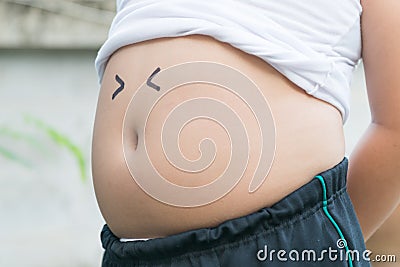 Children with overweight. Stock Photo