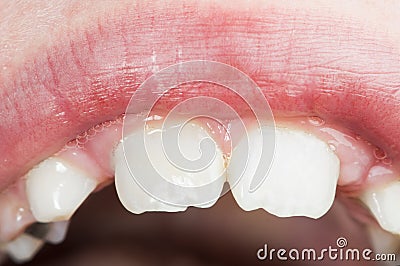Children's mouth and teeth Stock Photo