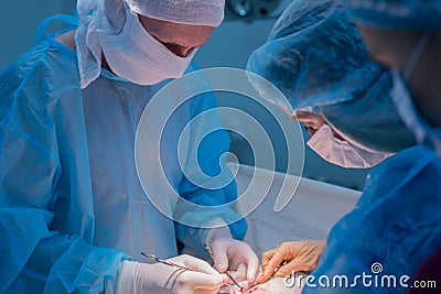 Children`s surgeons perform urological surgery. A man and a woman in a mask, and a blue sterile gown, in the operating room Stock Photo